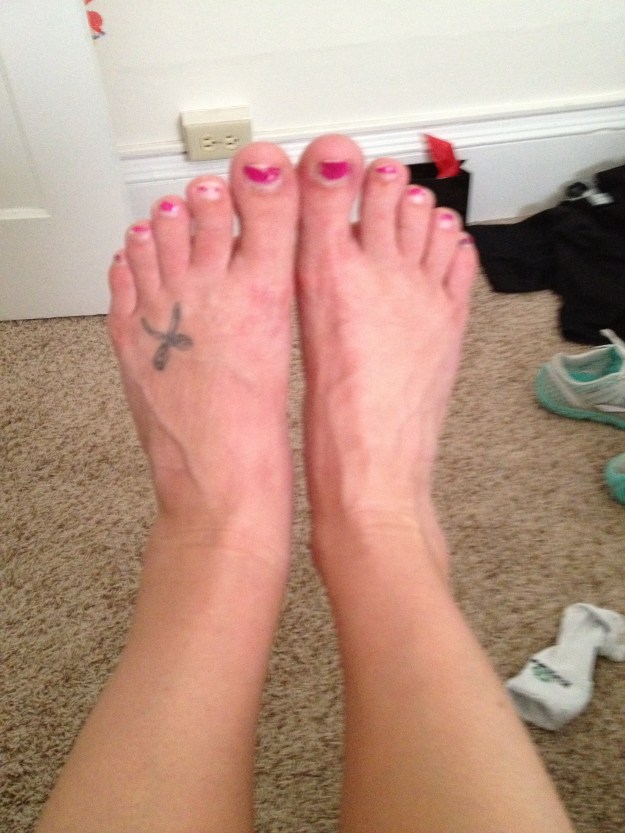 One of these ankles is not like the other. Do you think I needed a pedicure?