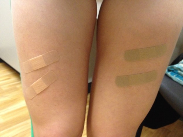 Four shots, two in each leg. I get to do these myself now...fun stuff.